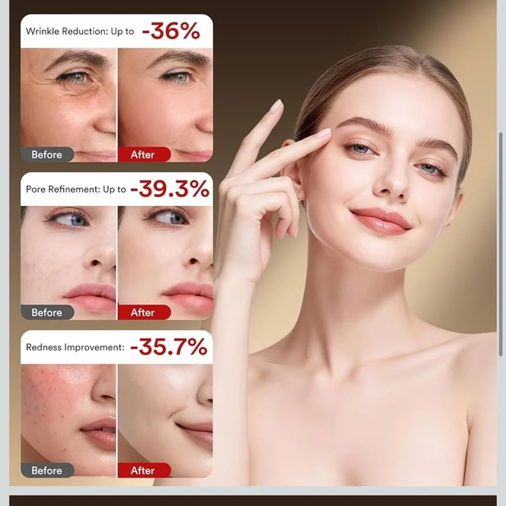 Red Light Therapy Facial Mask 324 LEDs and 4 mode light therapy mask - Picture 3 of 8